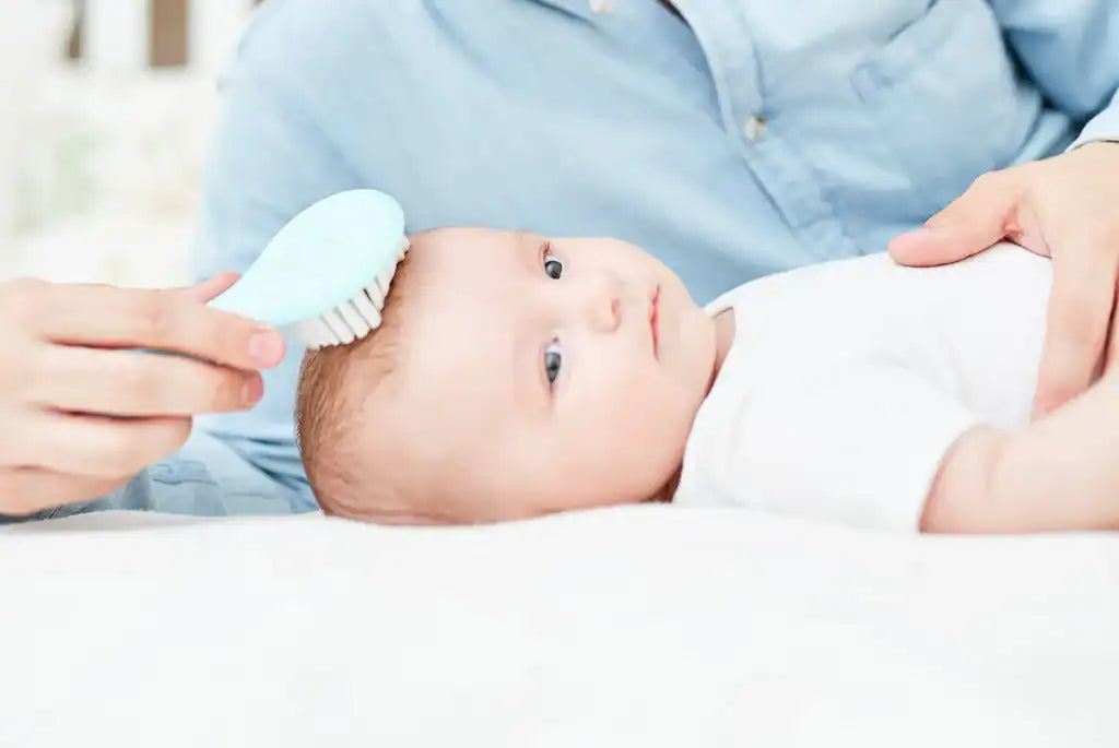 Natural Remedies for Cradle Cap in Babies